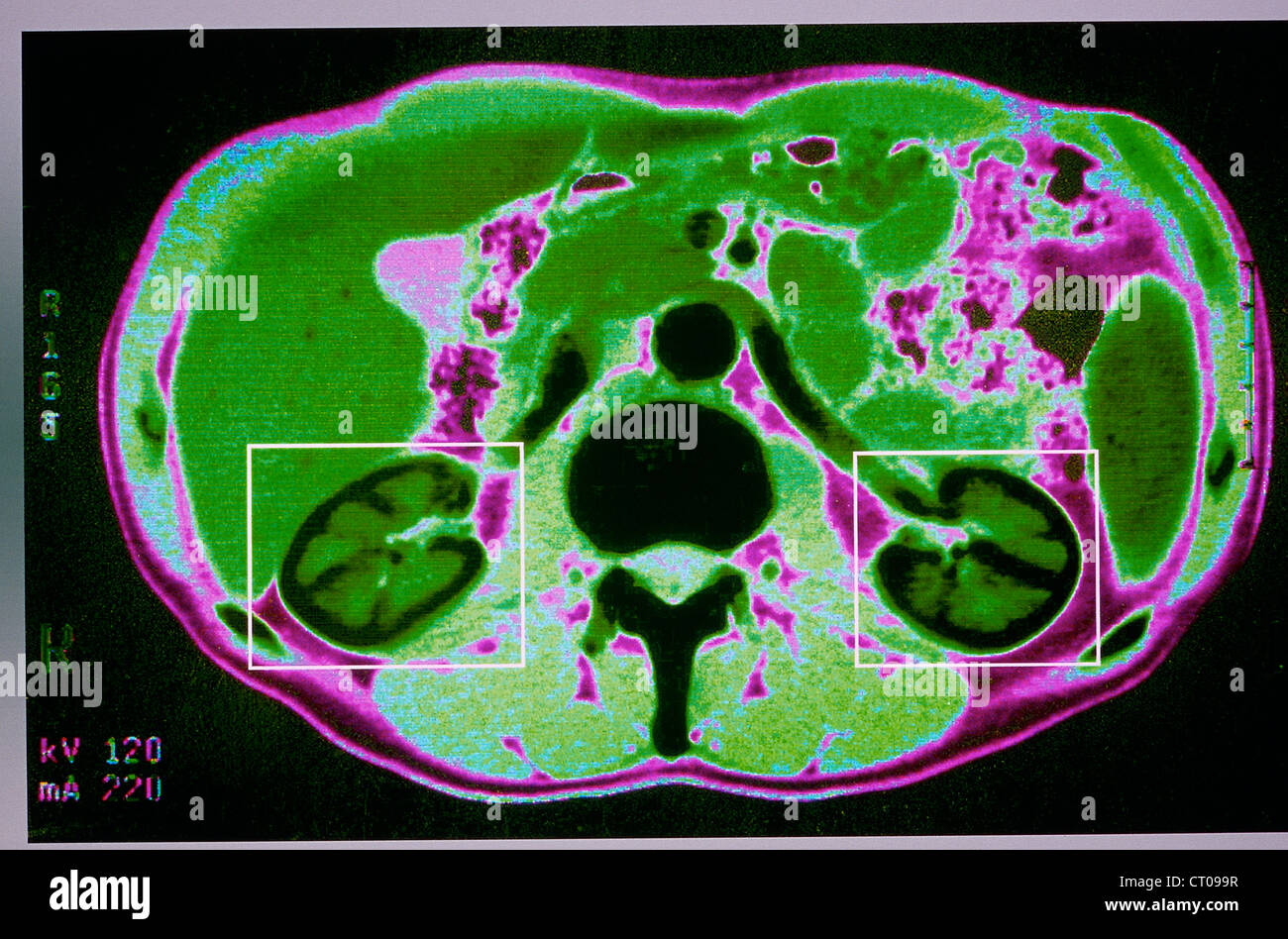 Cat kidney hires stock photography and images Alamy