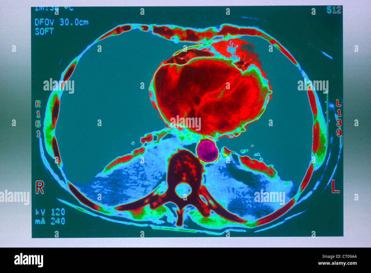 Cardiac scan hi-res stock photography and images - Alamy