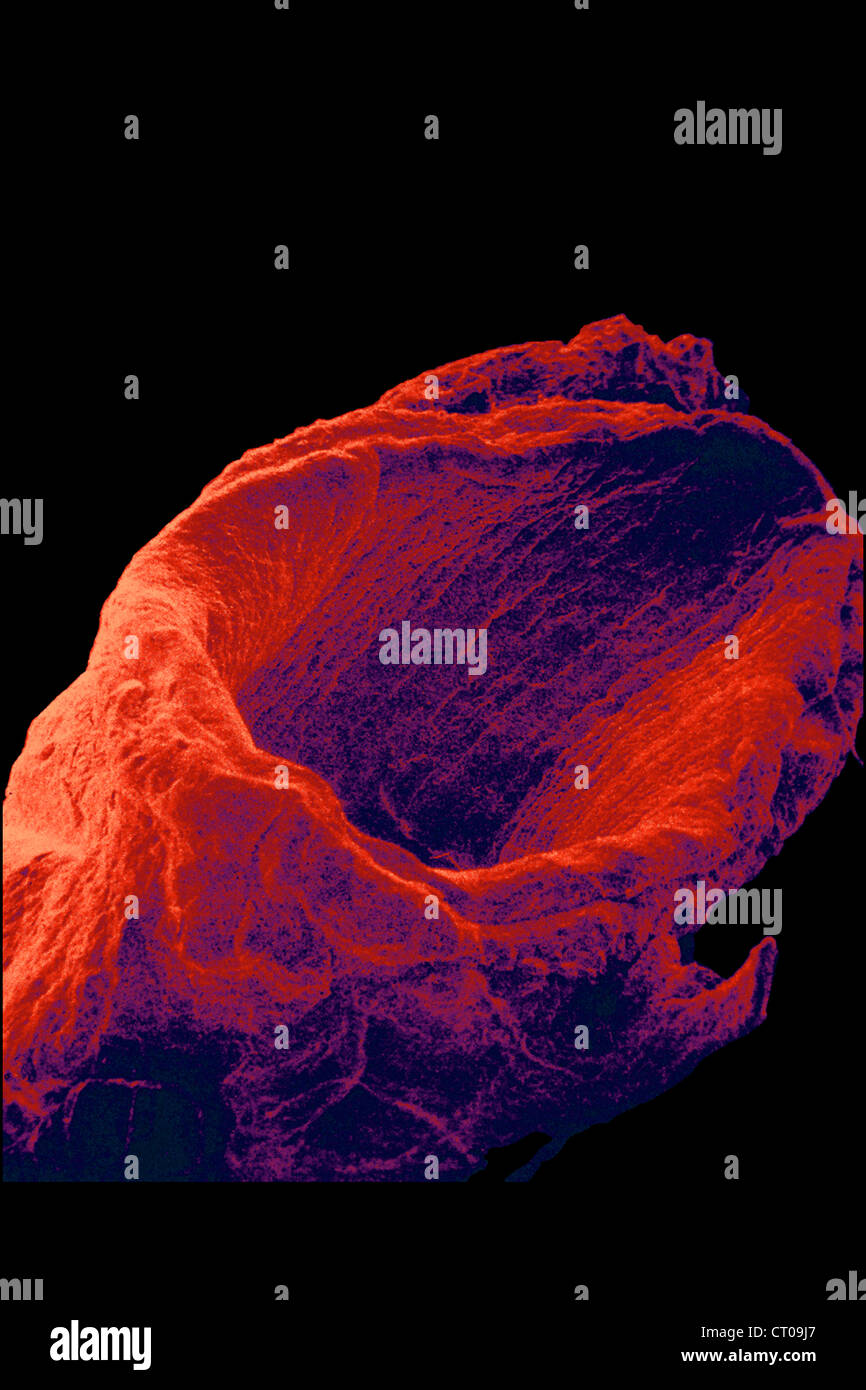 VEIN, SEM Stock Photo