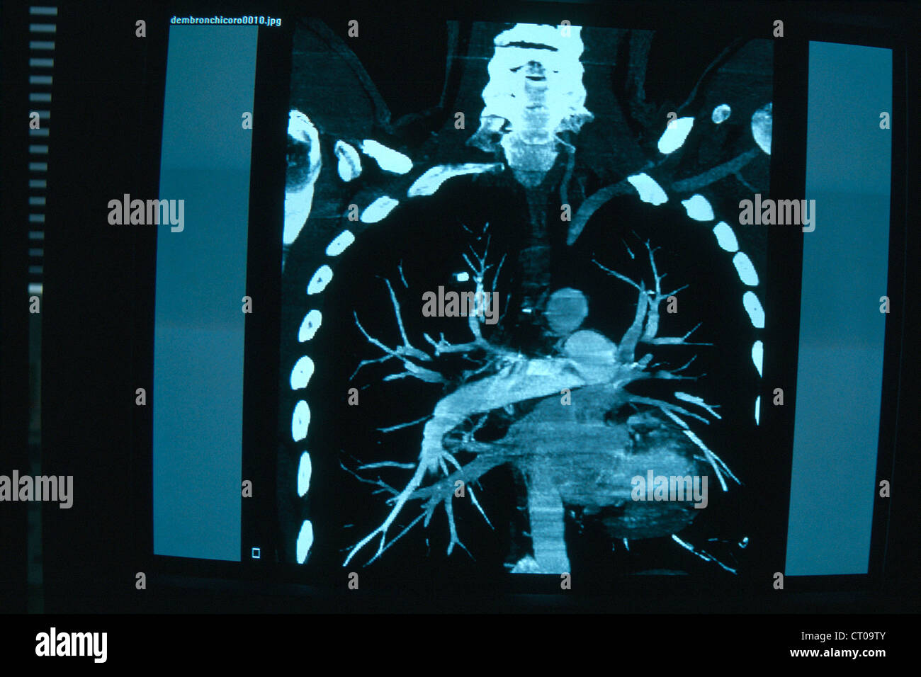 HELICAL CT SCANNER Stock Photo Alamy