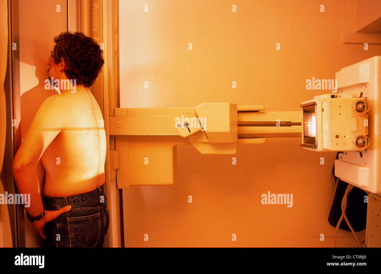 LUNG, XRAY EXAMINATION Stock Photo Alamy