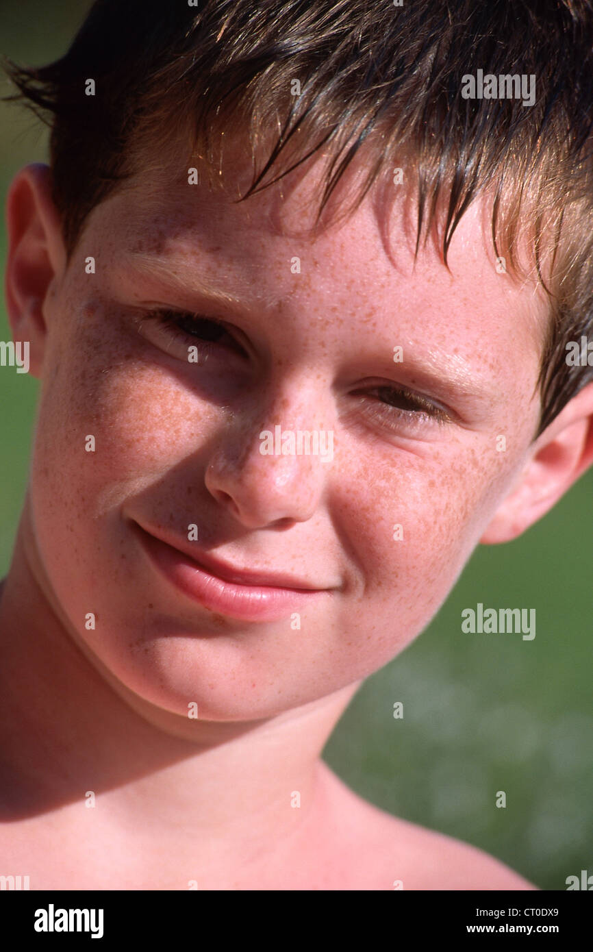 FRECKLE Stock Photo