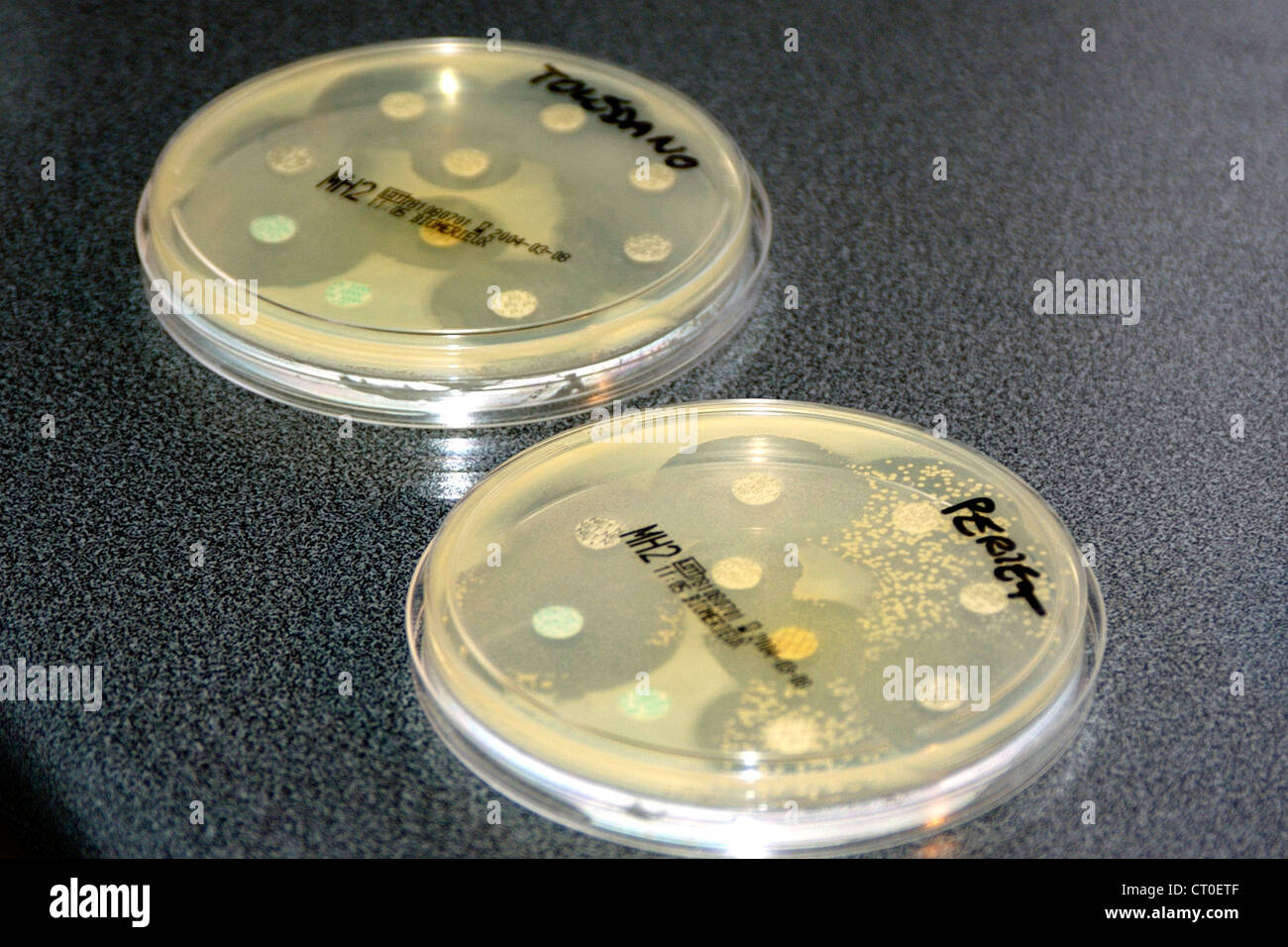 Kirby bauer antibiotic sensitivity test hi res stock photography and