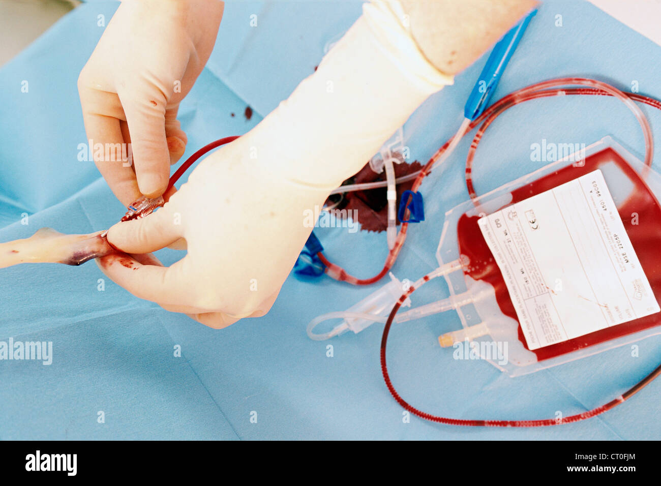 CORD BLOOD SPECIMEN Stock Photo