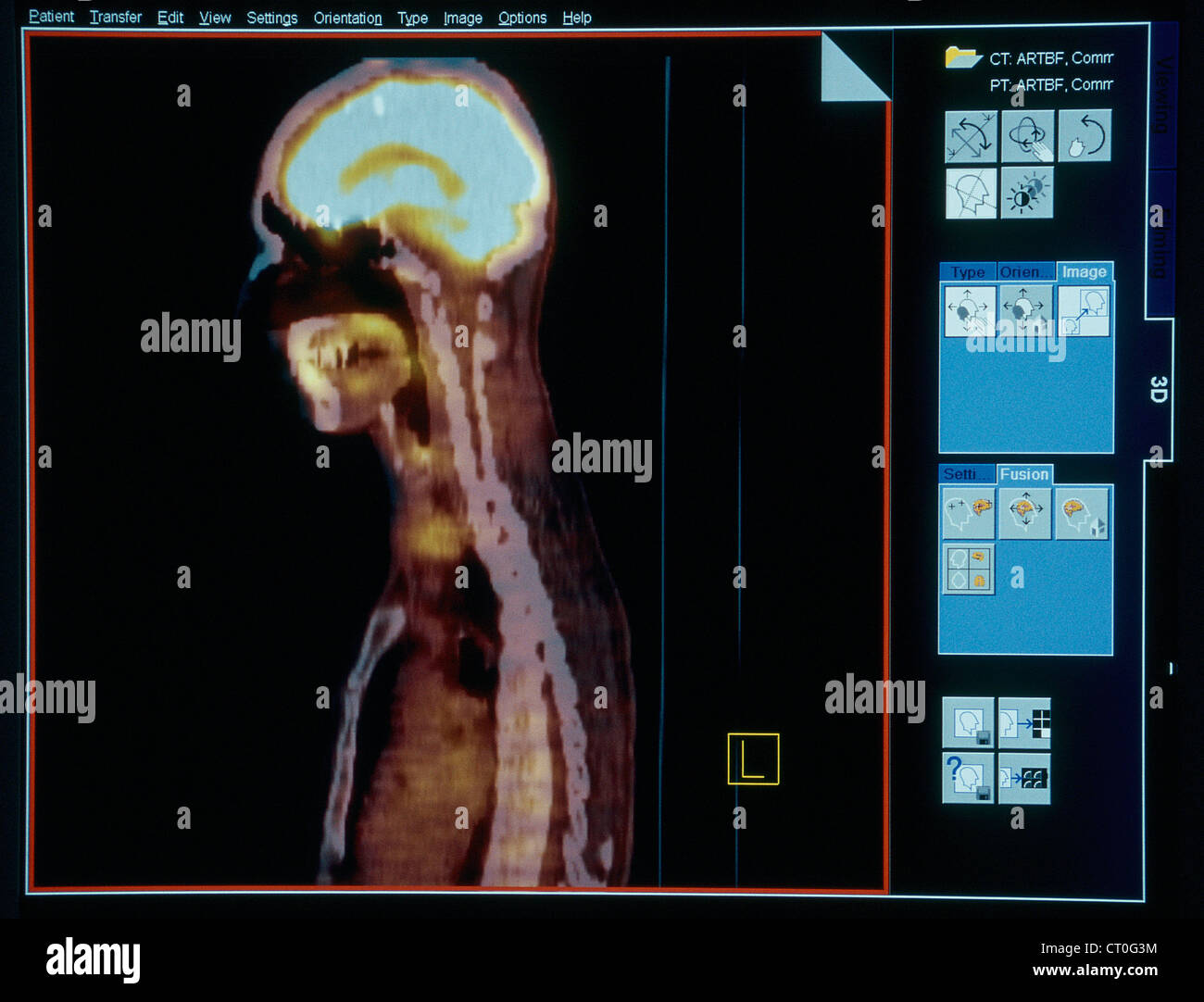 PETSCAN Stock Photo - Alamy