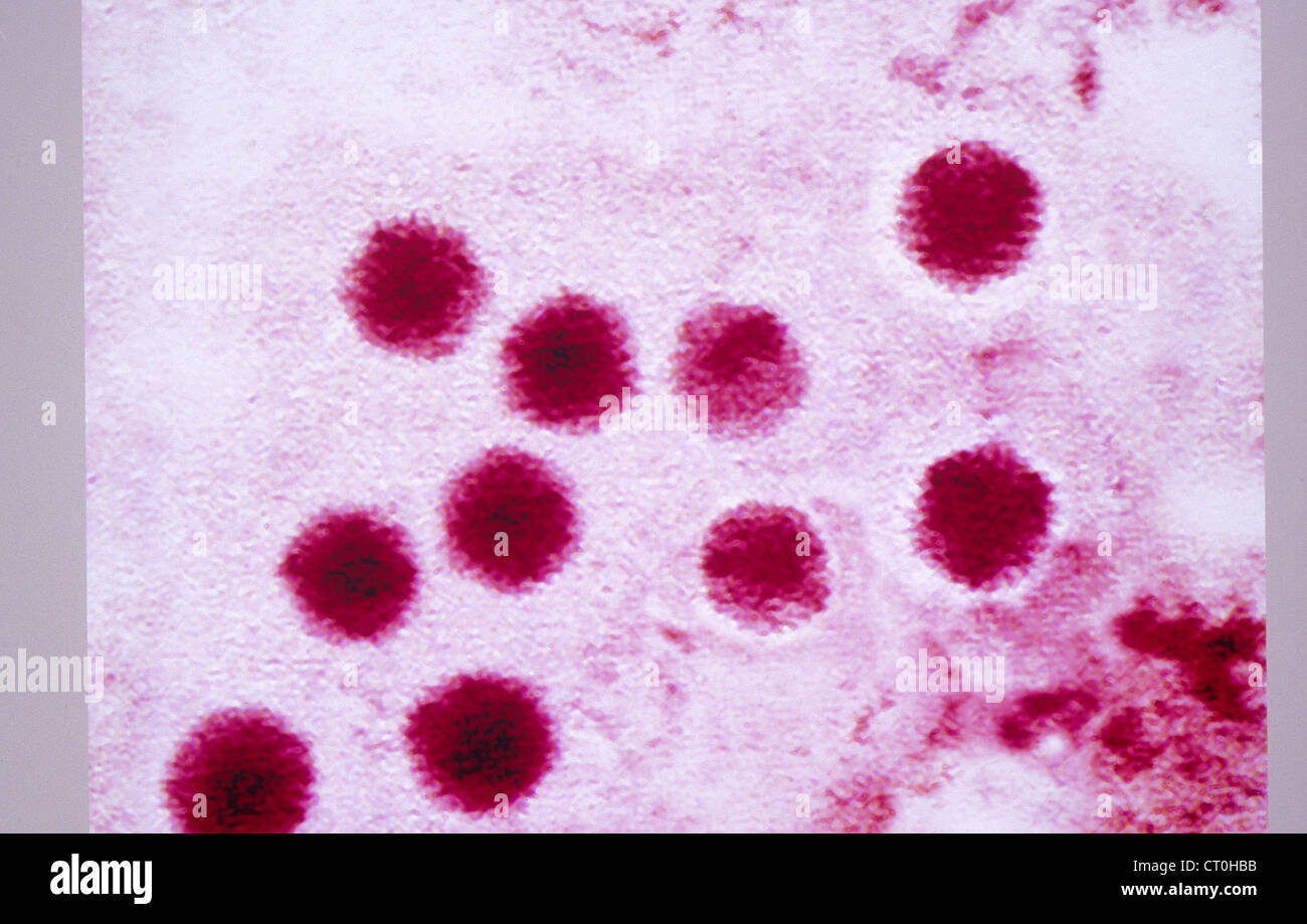 HEPATITIS A VIRUS Stock Photo