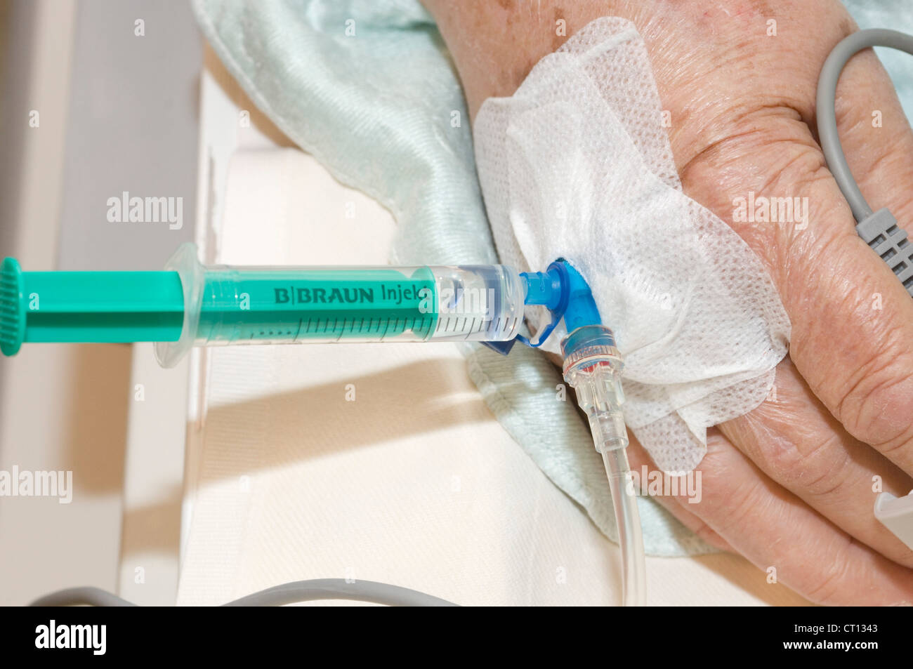 An intravenous drip in the finger of a male patient undergoing an endoscopic procedure. Stock Photo