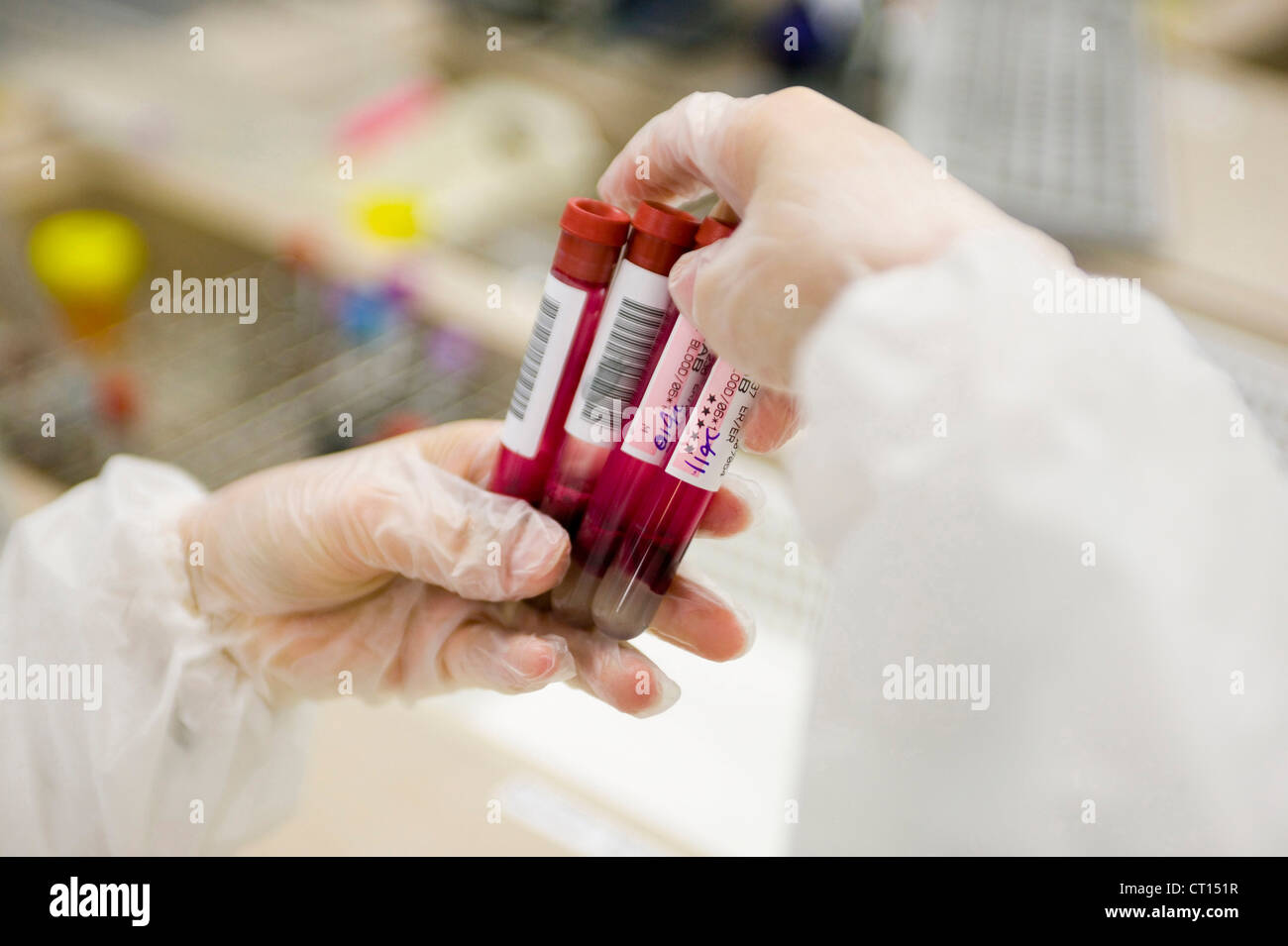 A doctor holding blood samples Stock Photo