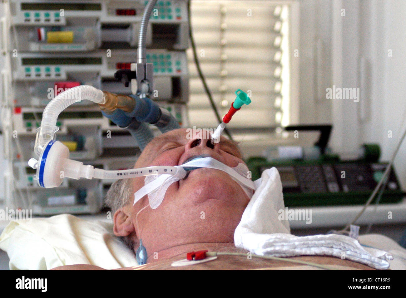 What is an artificial coma What is an artificial coma