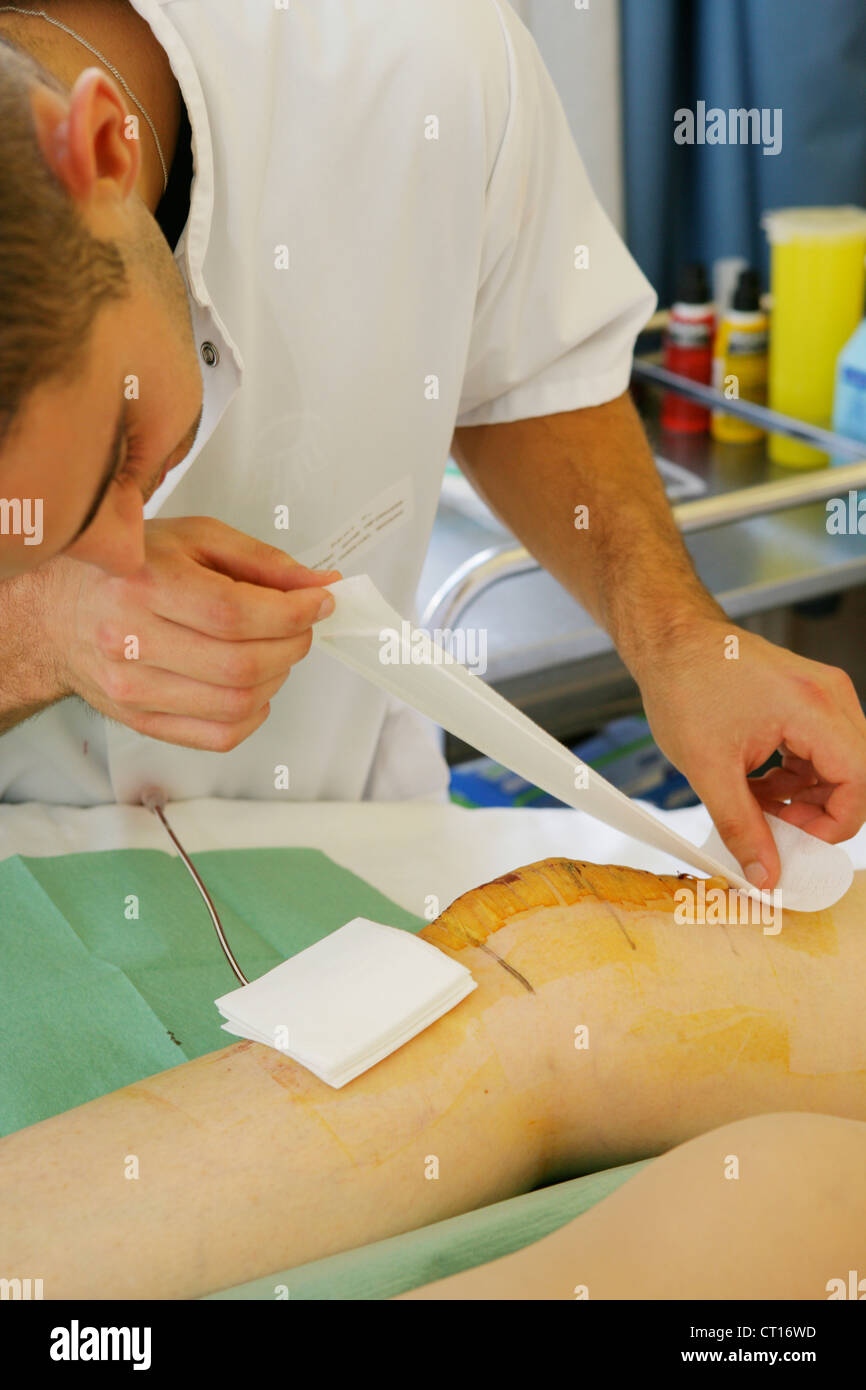 SURGICAL WOUND Stock Photo