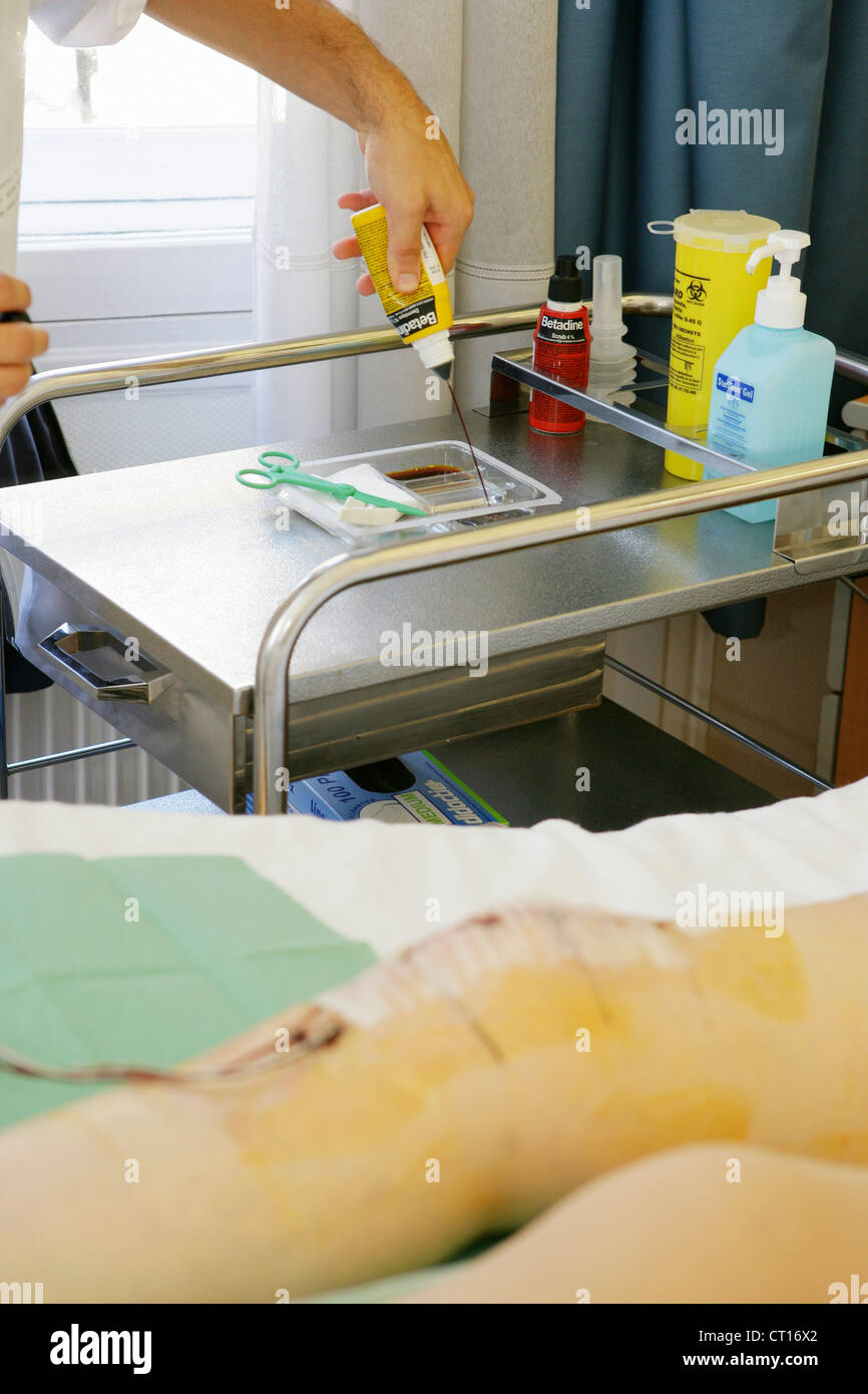 SURGICAL WOUND Stock Photo