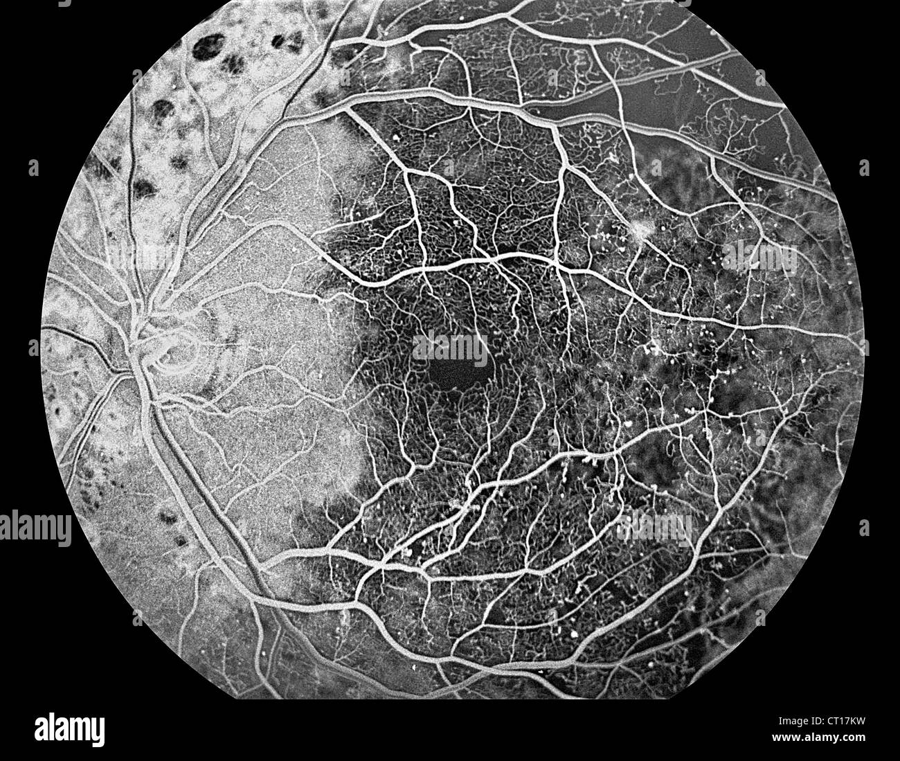 Fundus Black and White Stock Photos & Images - Page 2 - Alamy