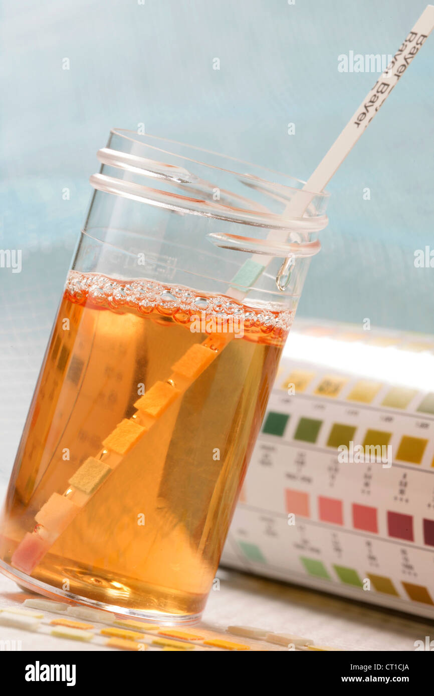 URINE TEST STRIP Stock Photo Alamy