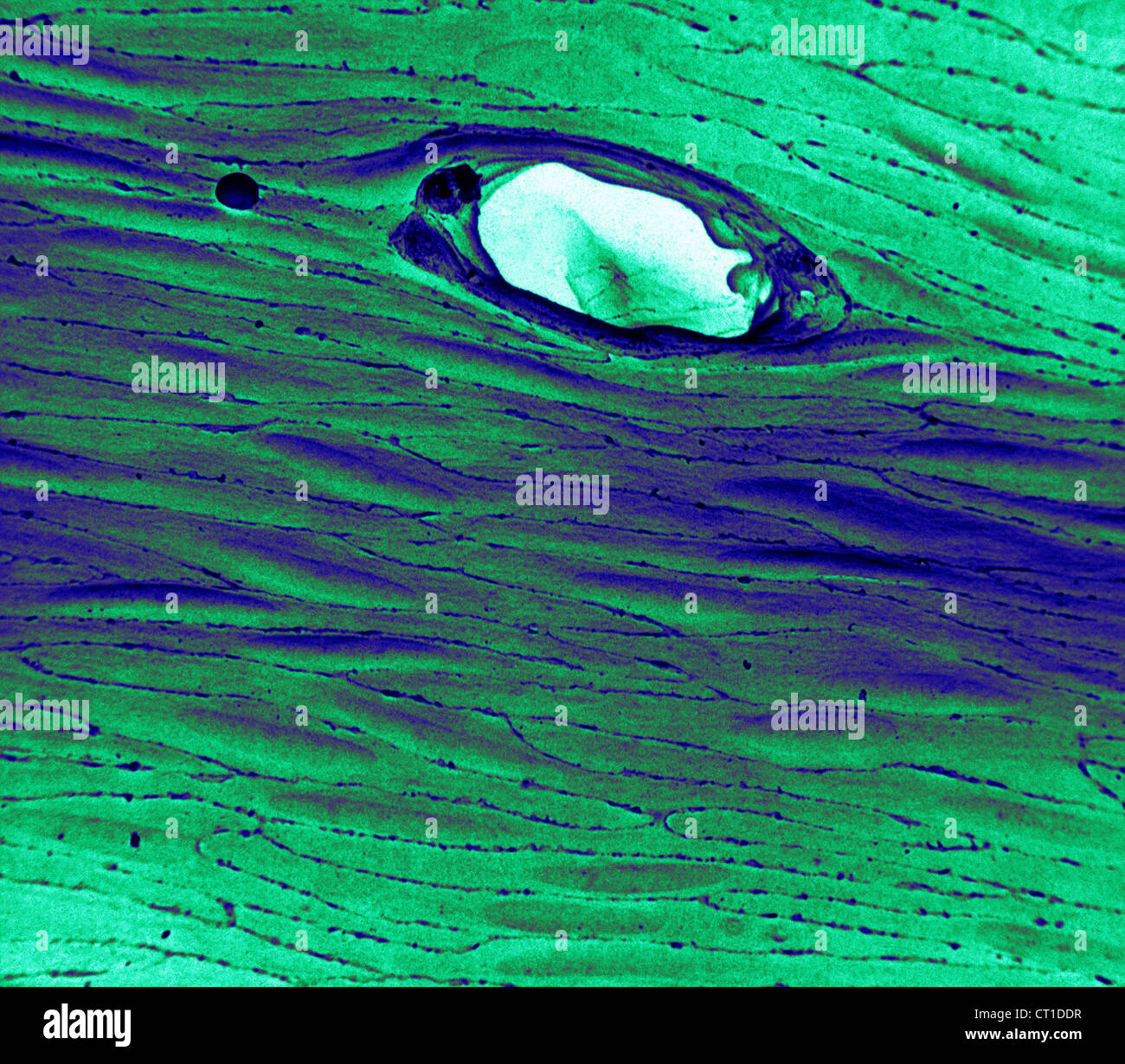 ENDOTHELIUM RABBIT, SEM Stock Photo