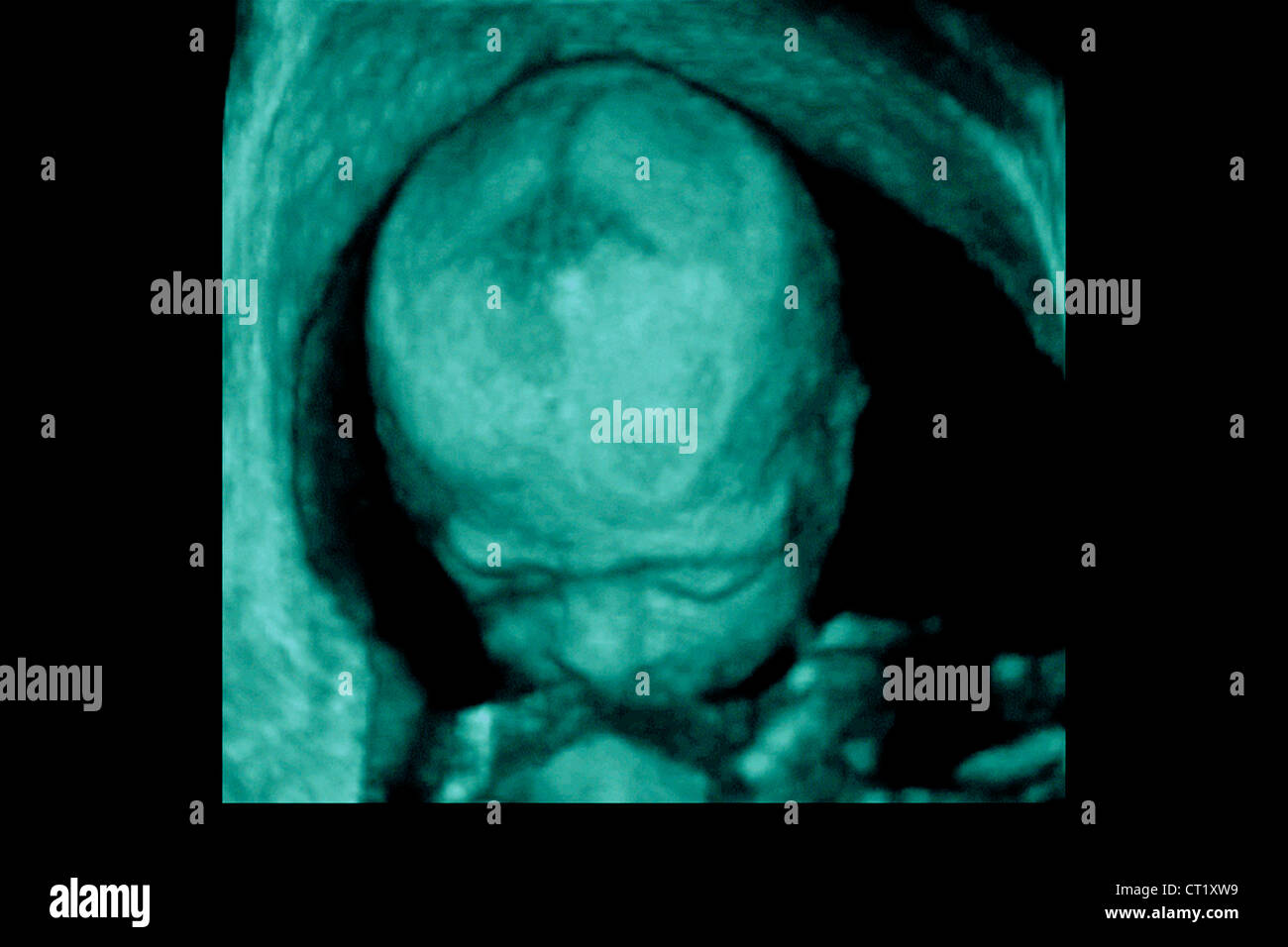 3d sonography hi-res stock photography and images - Alamy