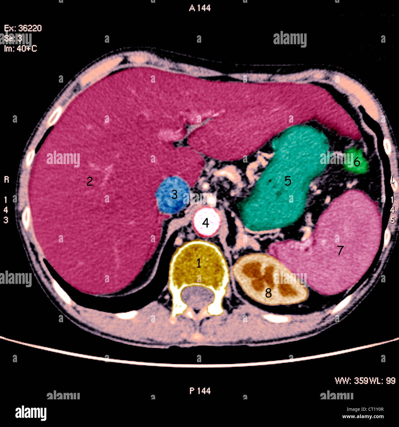 Liver scan hires stock photography and images Alamy