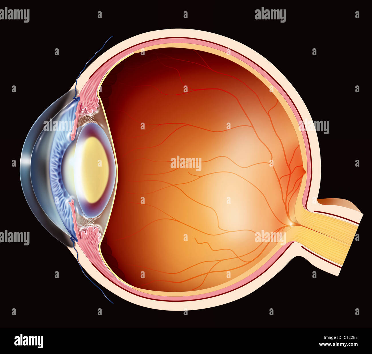 CATARACT, DRAWING Stock Photo