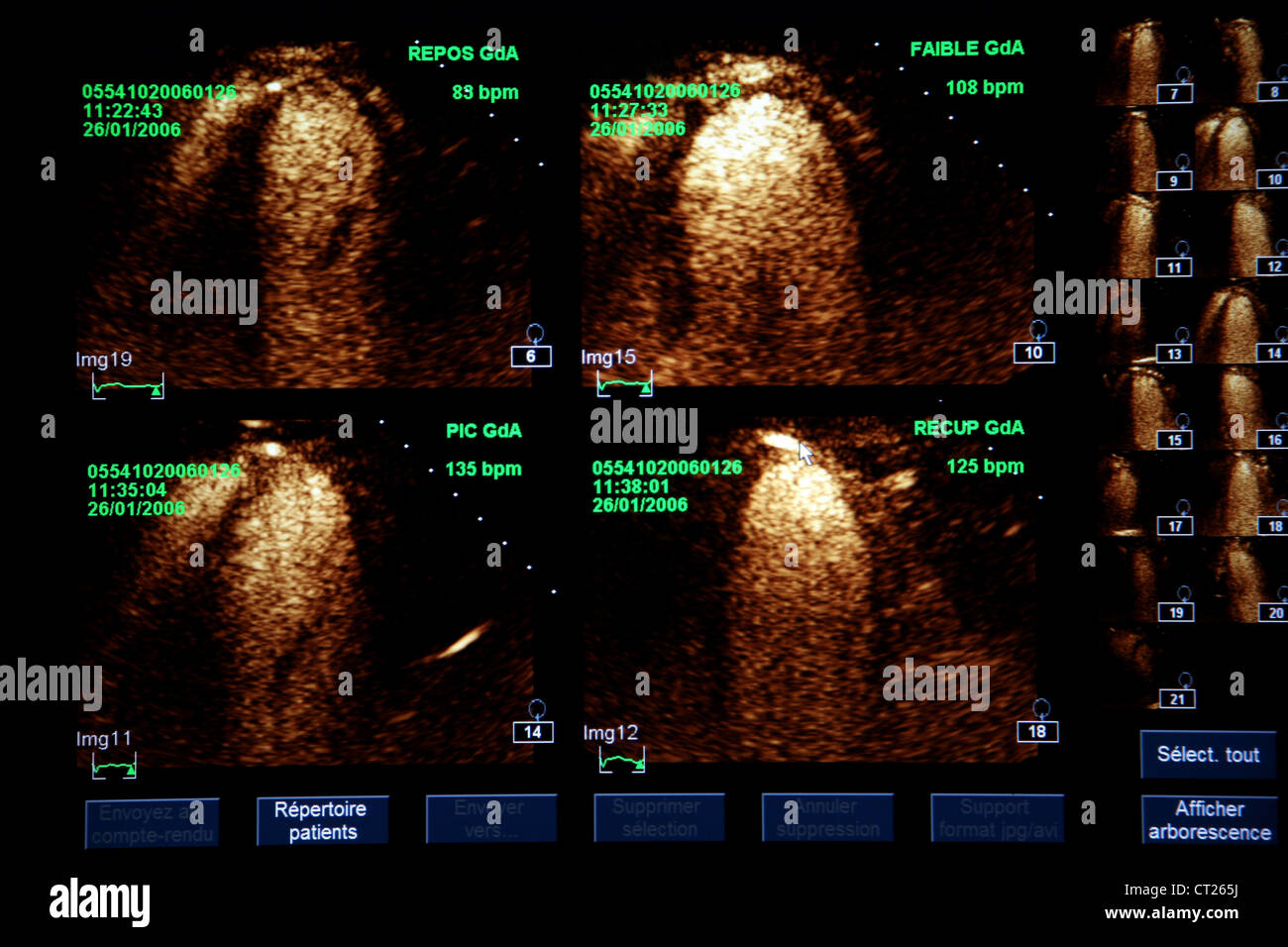 3d ultrasonography result hi-res stock photography and images - Alamy