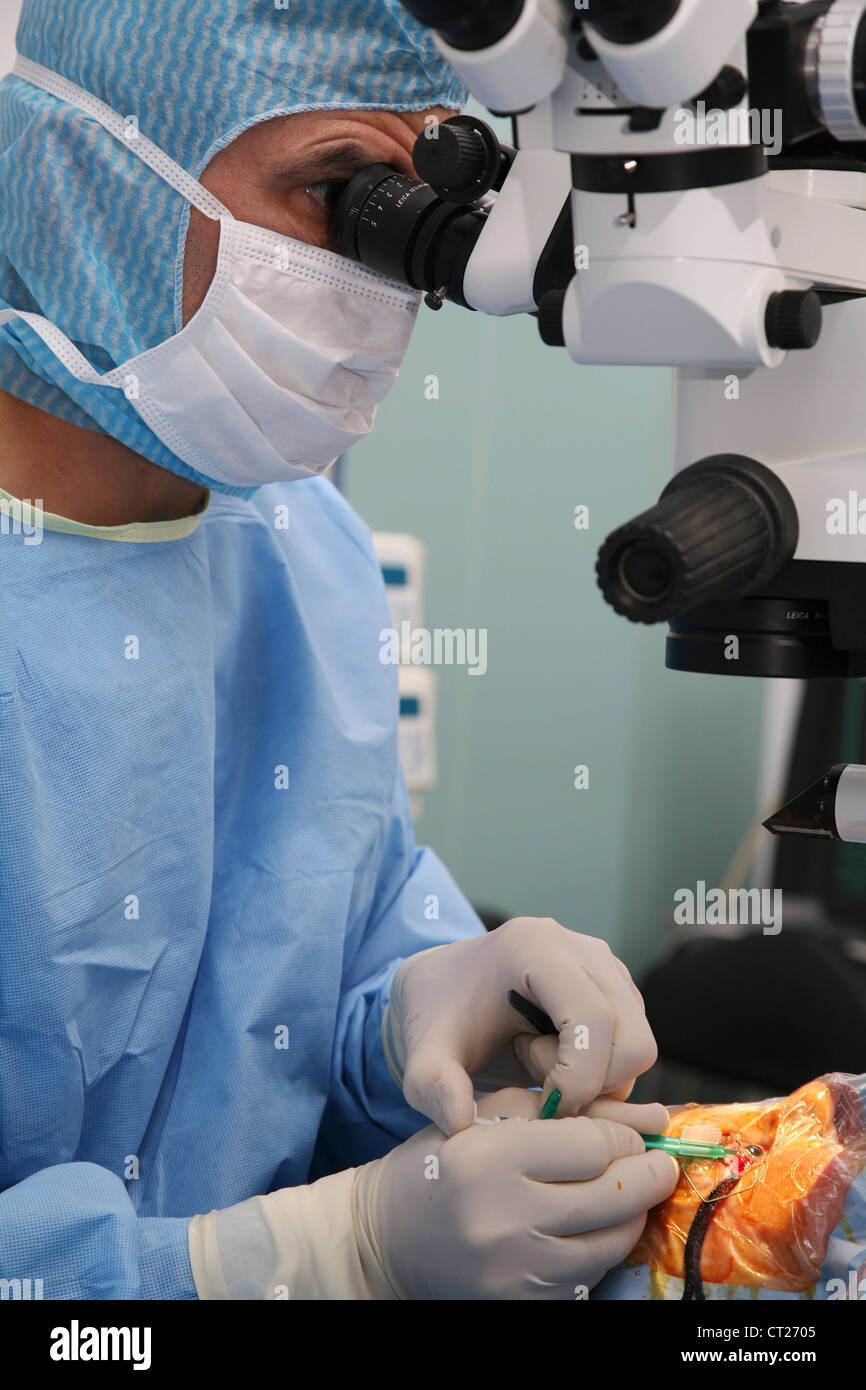 Intraocular lens placement hi-res stock photography and images - Alamy