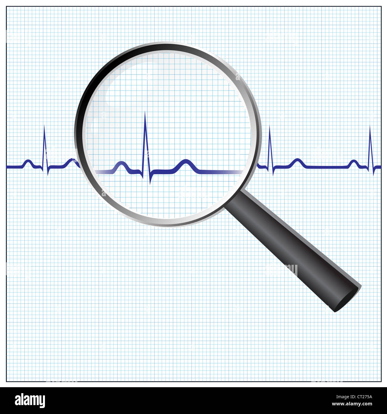 Heart checkup, Magnifying glass on an ECG Stock Photo