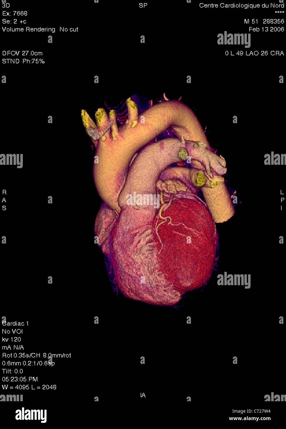 HEART, 3D SCAN Stock Photo