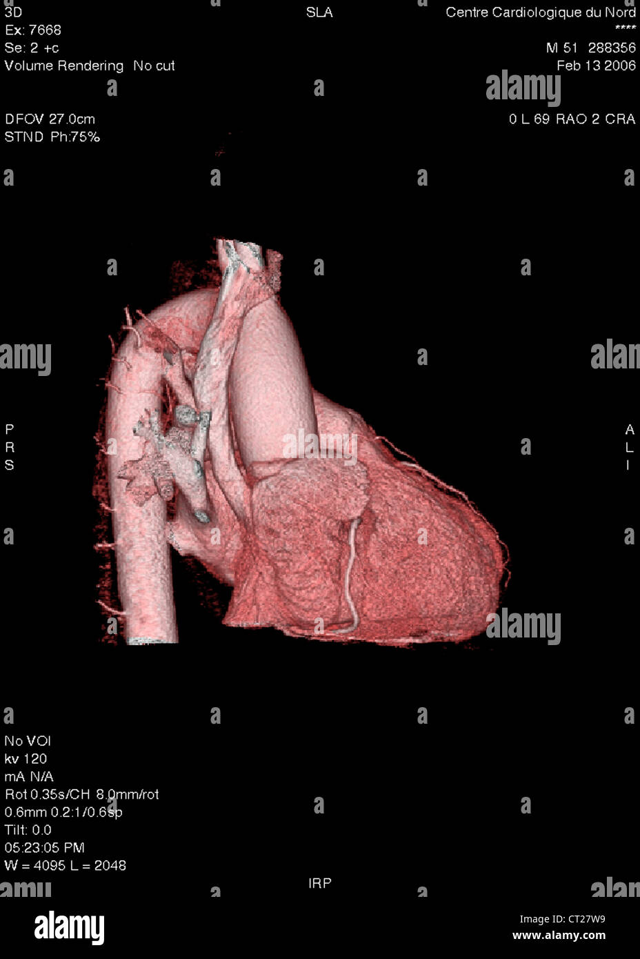HEART, 3D SCAN Stock Photo
