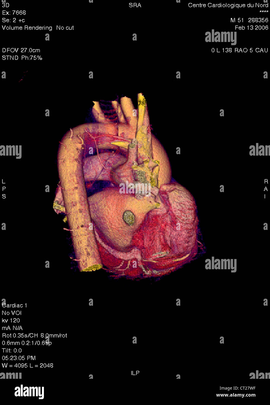HEART, 3D SCAN Stock Photo - Alamy