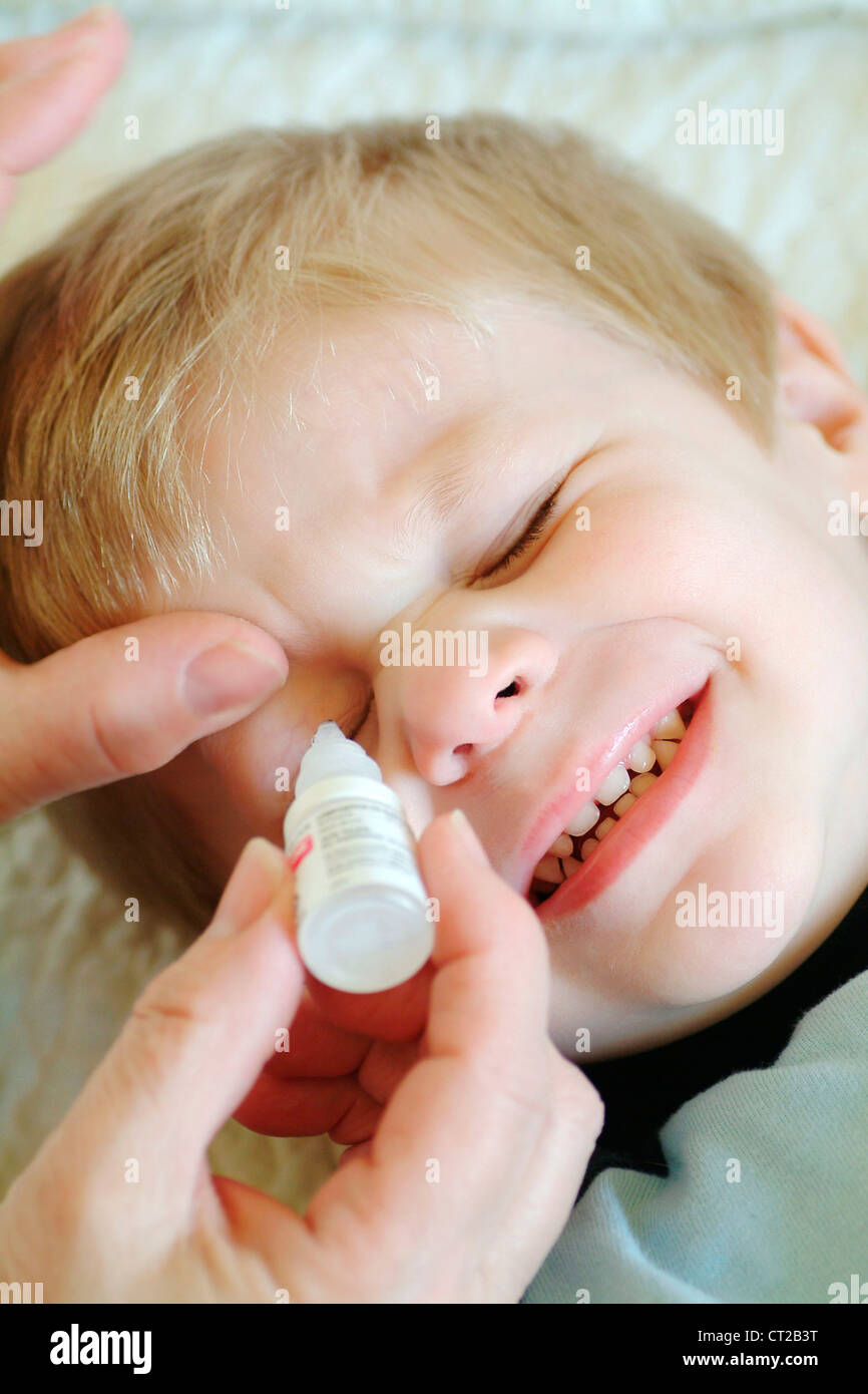 CHILD USING EYE LOTION Stock Photo Alamy