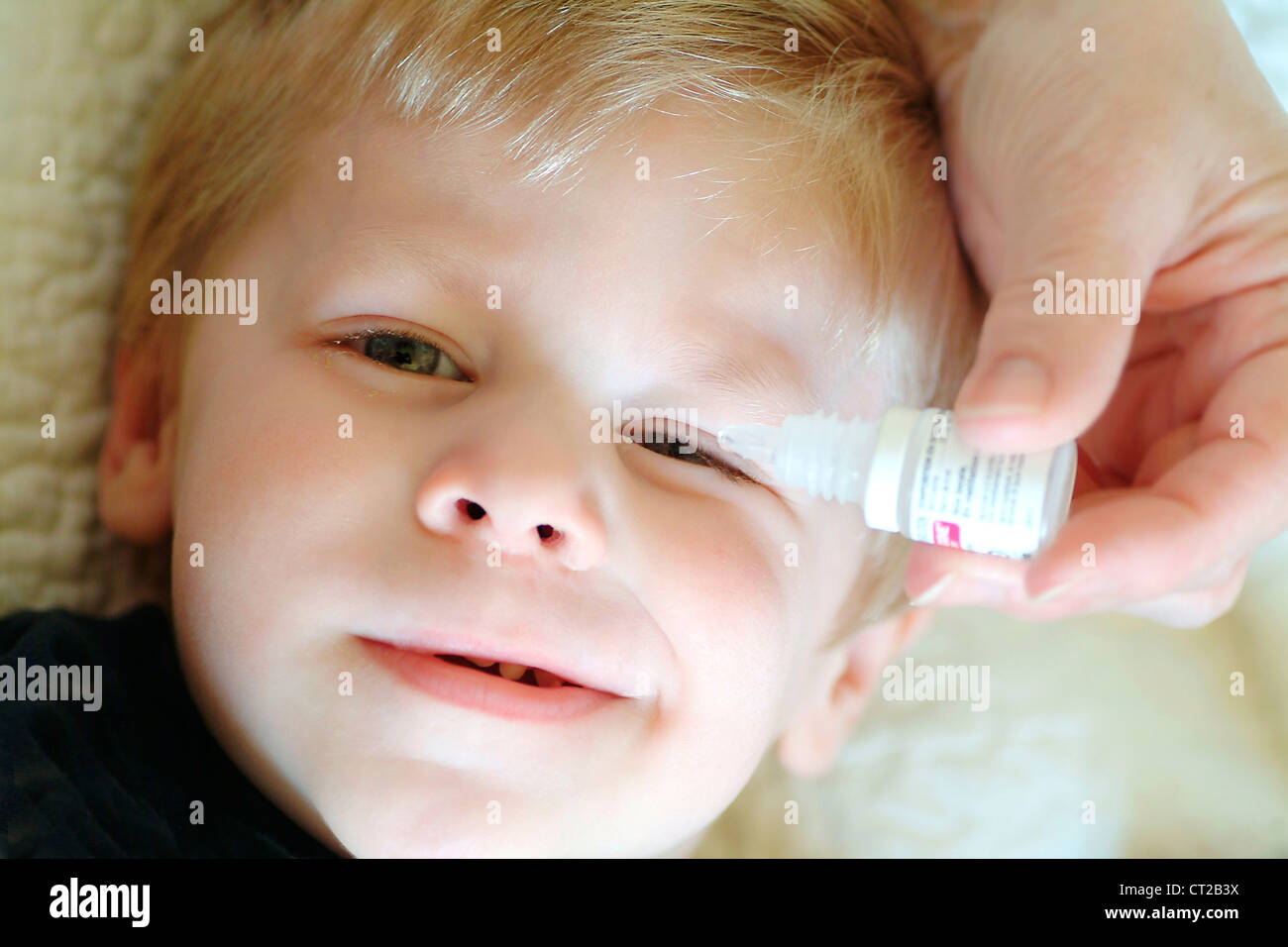 CHILD USING EYE LOTION Stock Photo Alamy