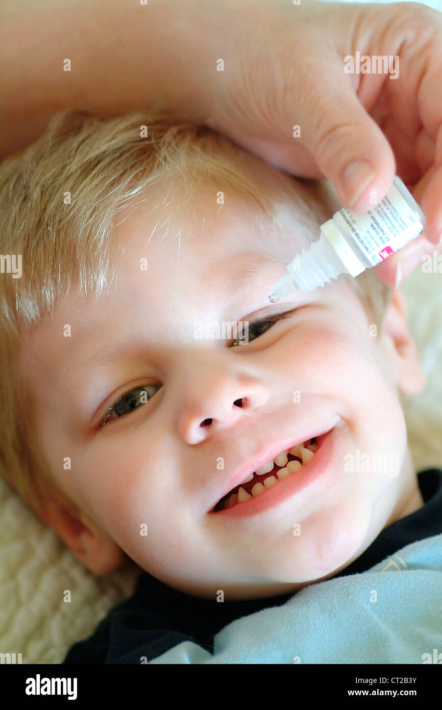 CHILD USING EYE LOTION Stock Photo Alamy