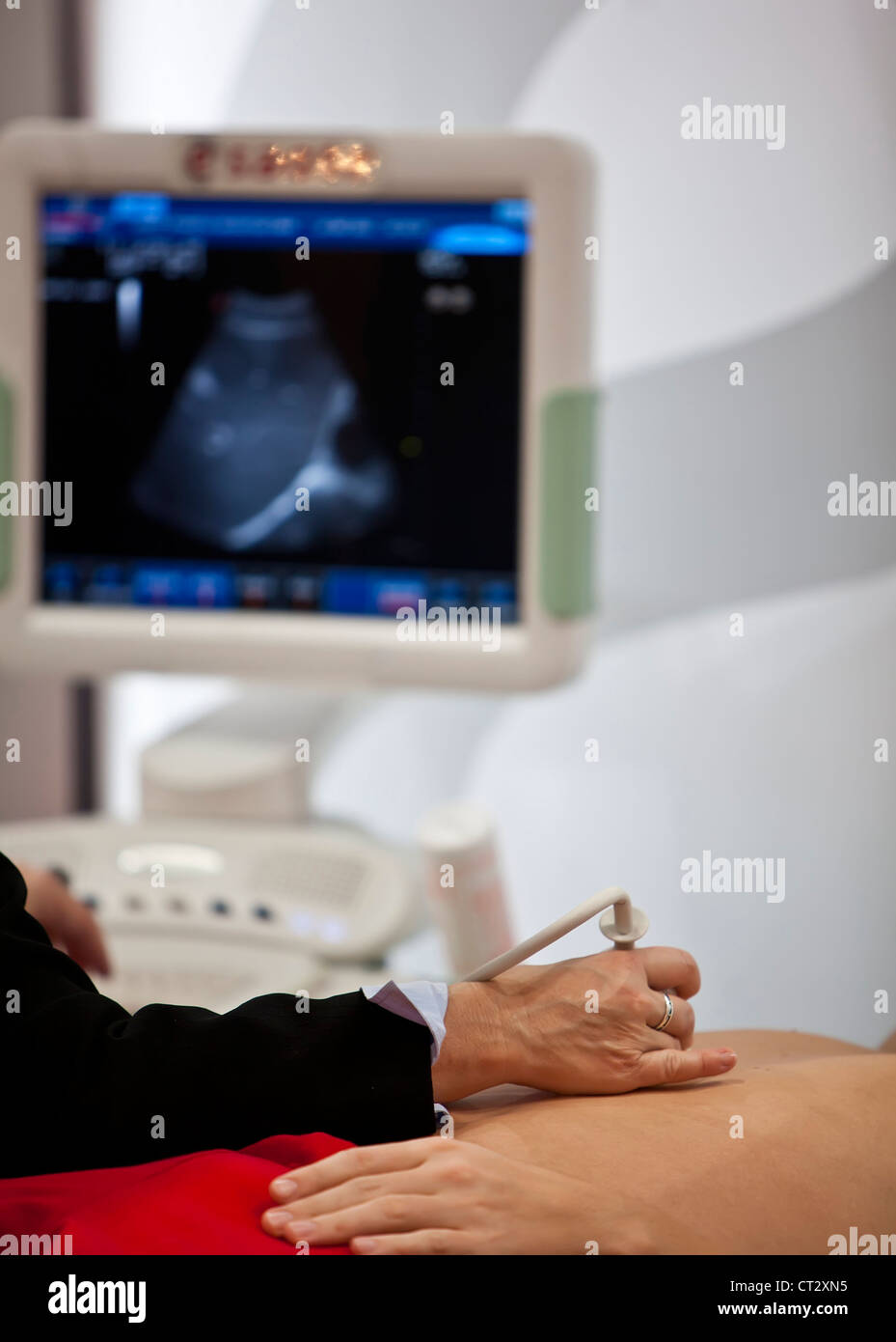 Ultrasound arm hi-res stock photography and images - Alamy