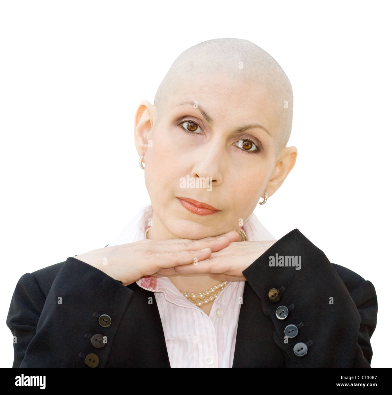 Portrait of cancer patient undergoing chemotherapy and loss of hair