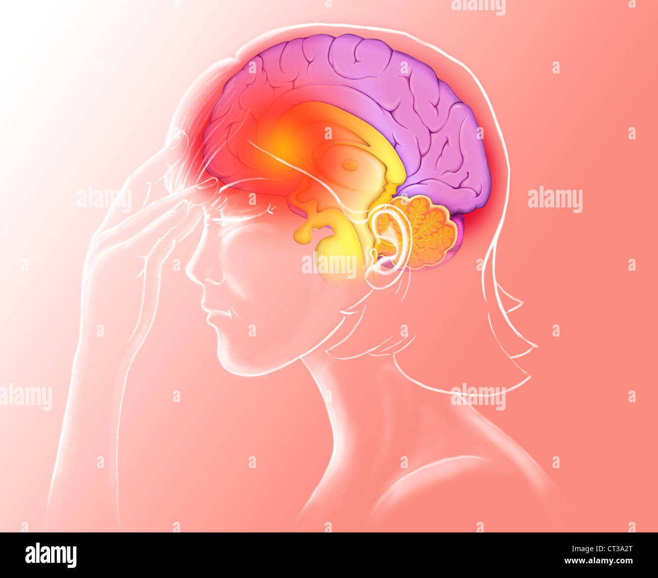 Headache concept drawing hires stock photography and images Alamy