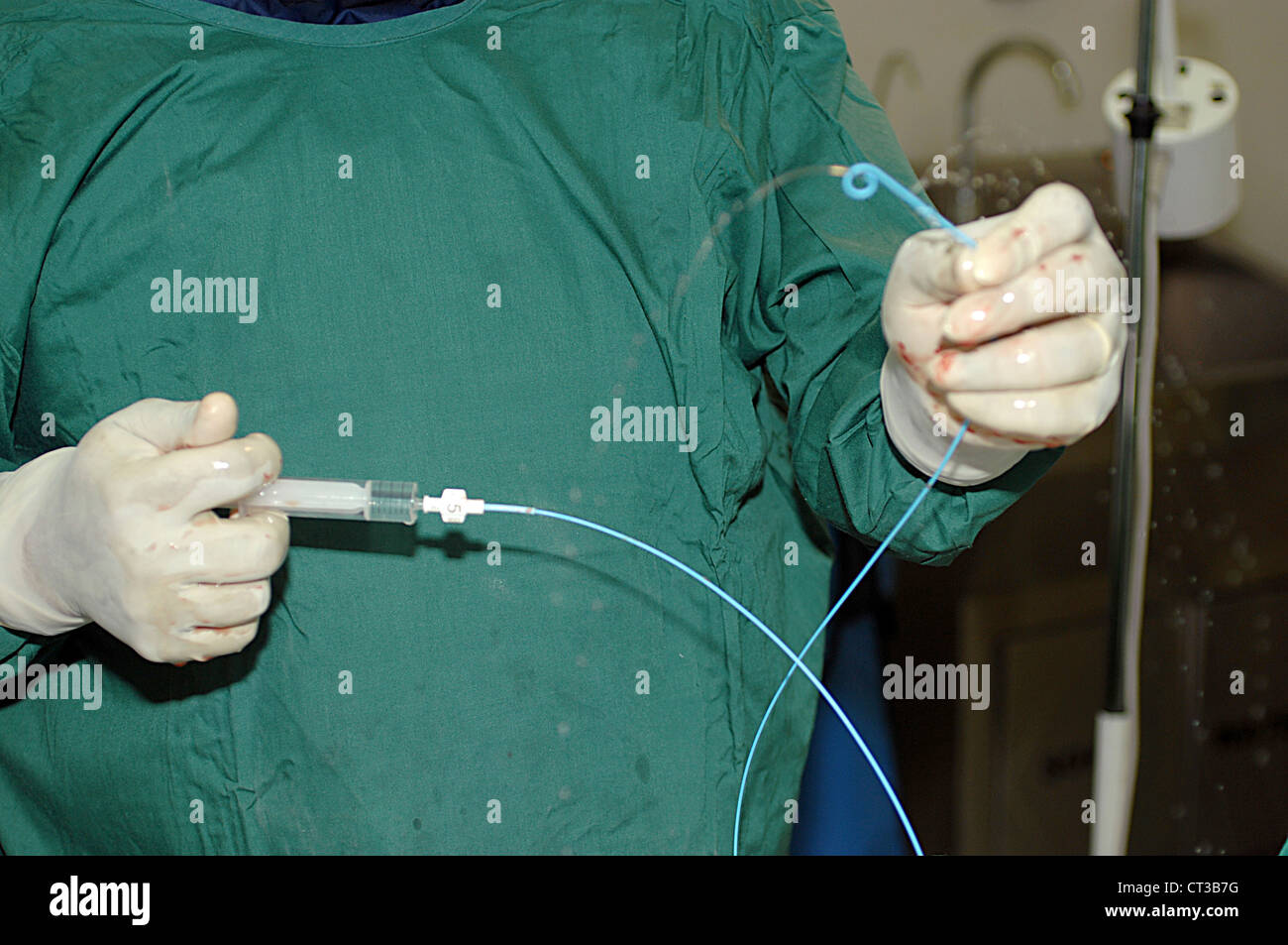 The cardiologist again flushes a saline solution through the catheter. Note the characteristic