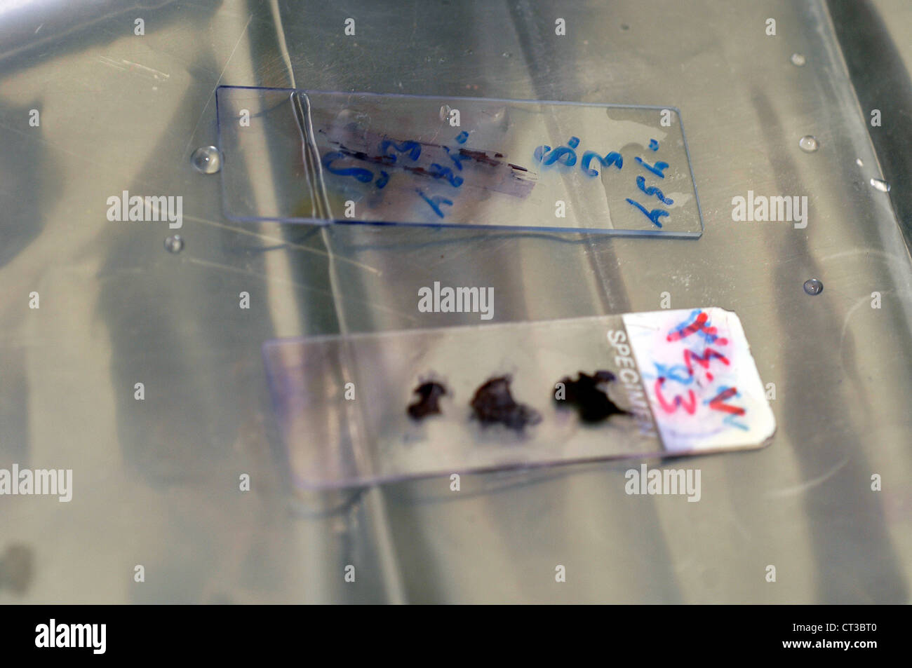 Two slides of various bacterial specimen, ready for analysis. Stock Photo