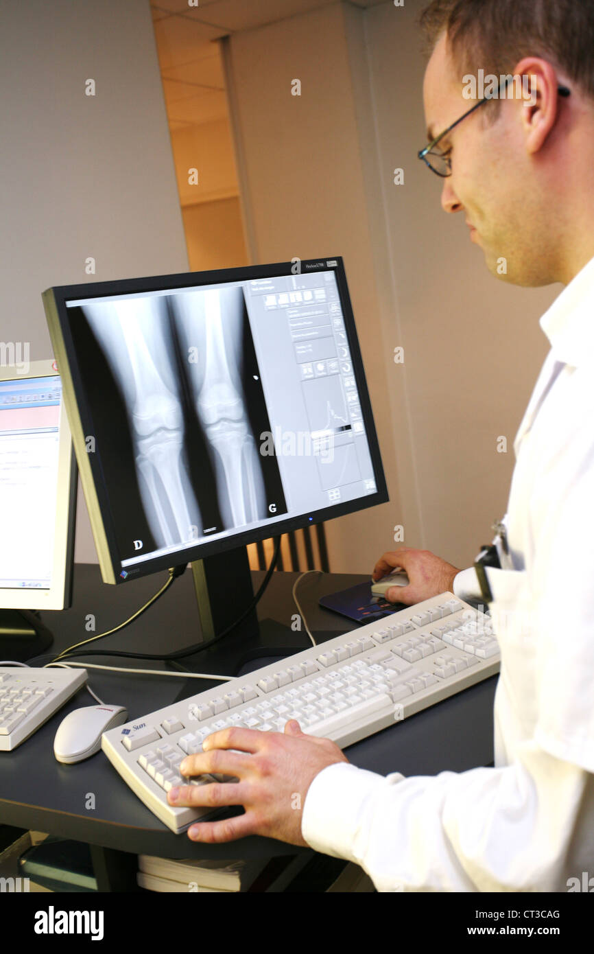 Child knee x ray hires stock photography and images Alamy