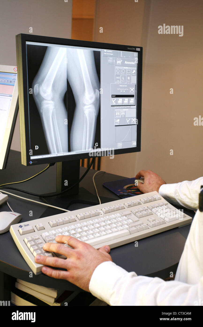 Child knee x ray hires stock photography and images Alamy