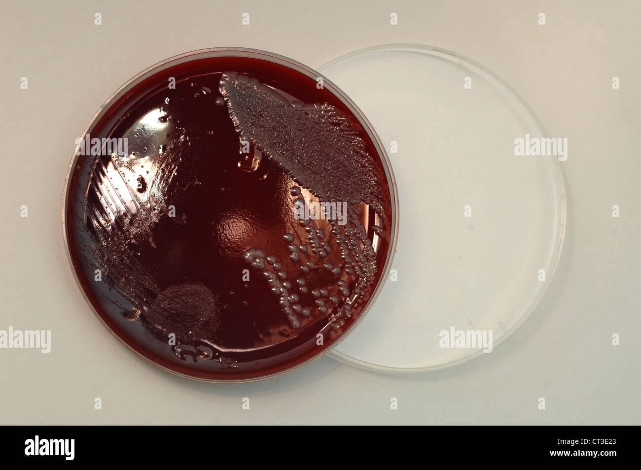 A sample of cultured blood-poisoning bacteria on an agar plate. Stock Photo