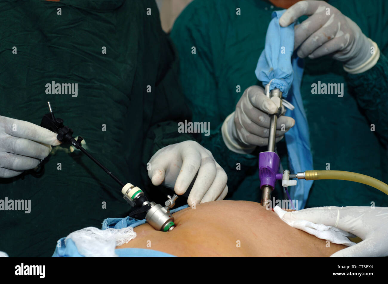 A surgeon (right) maneuveres a laparoscopic instrument into the abdominal cavity whist his assistant (left) operates the camera; providing the surgeon with a view of the inside of the abdomen. Stock Photo