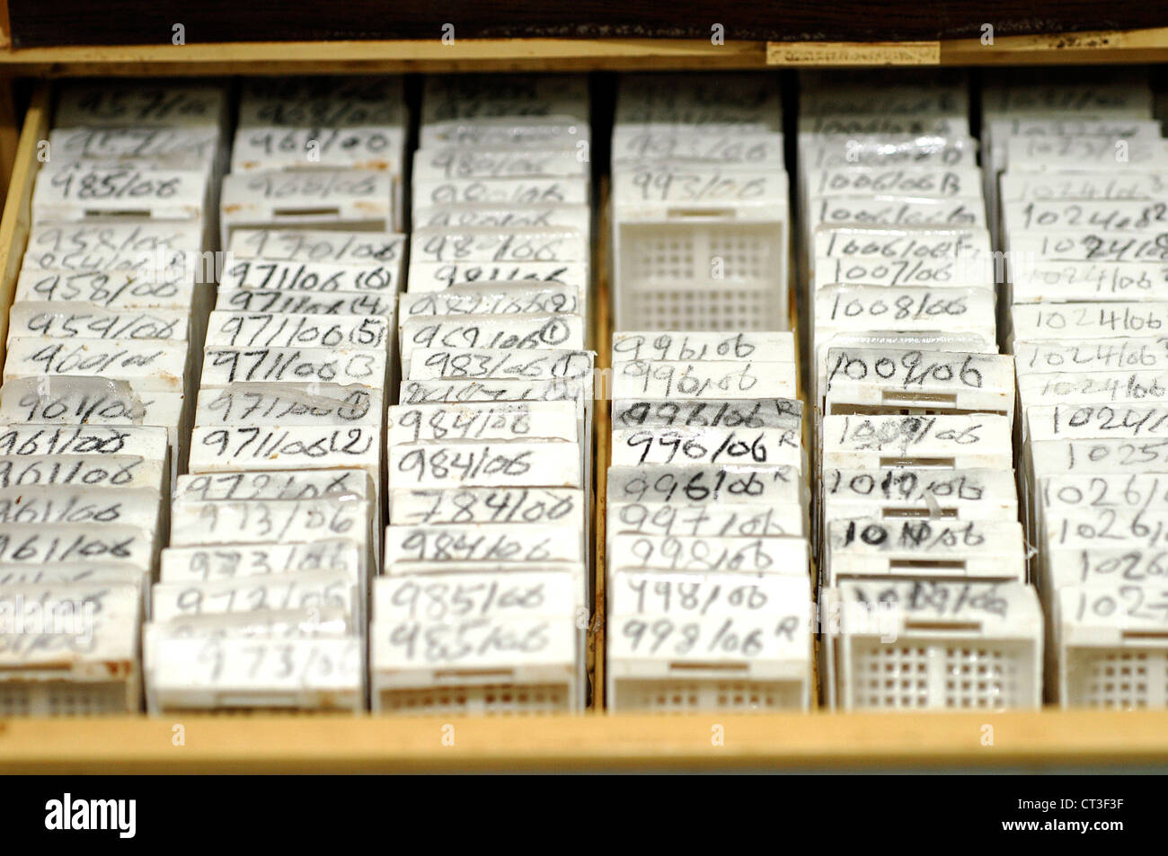 An array of microscope slides about to be examined for any signs of pathology. Stock Photo