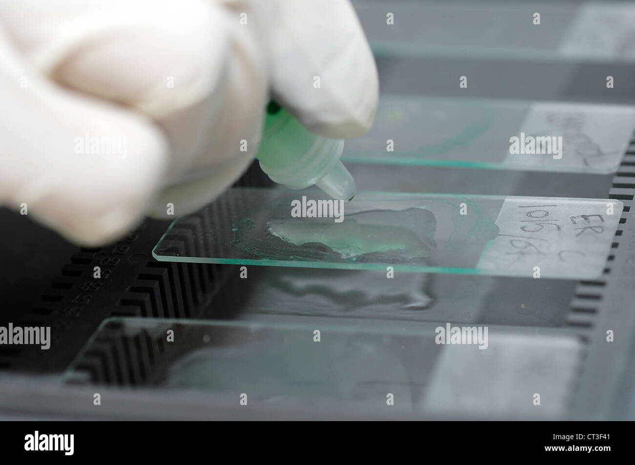 A pathologist placing specimen onto microscopic slides Stock Photo Alamy