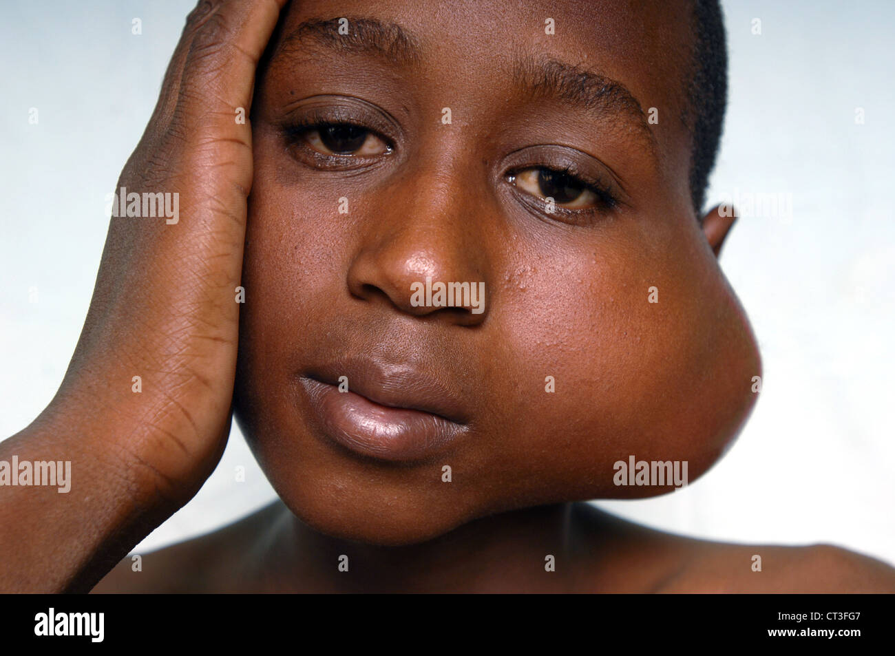 Download Preauricular Lymph Nodes Lump Under Ear Lobe Behind Jaw Bone Images