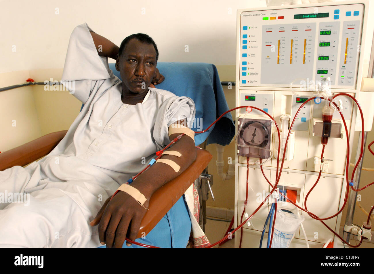 A man lays patiently while attached to a dialysis machine. The image