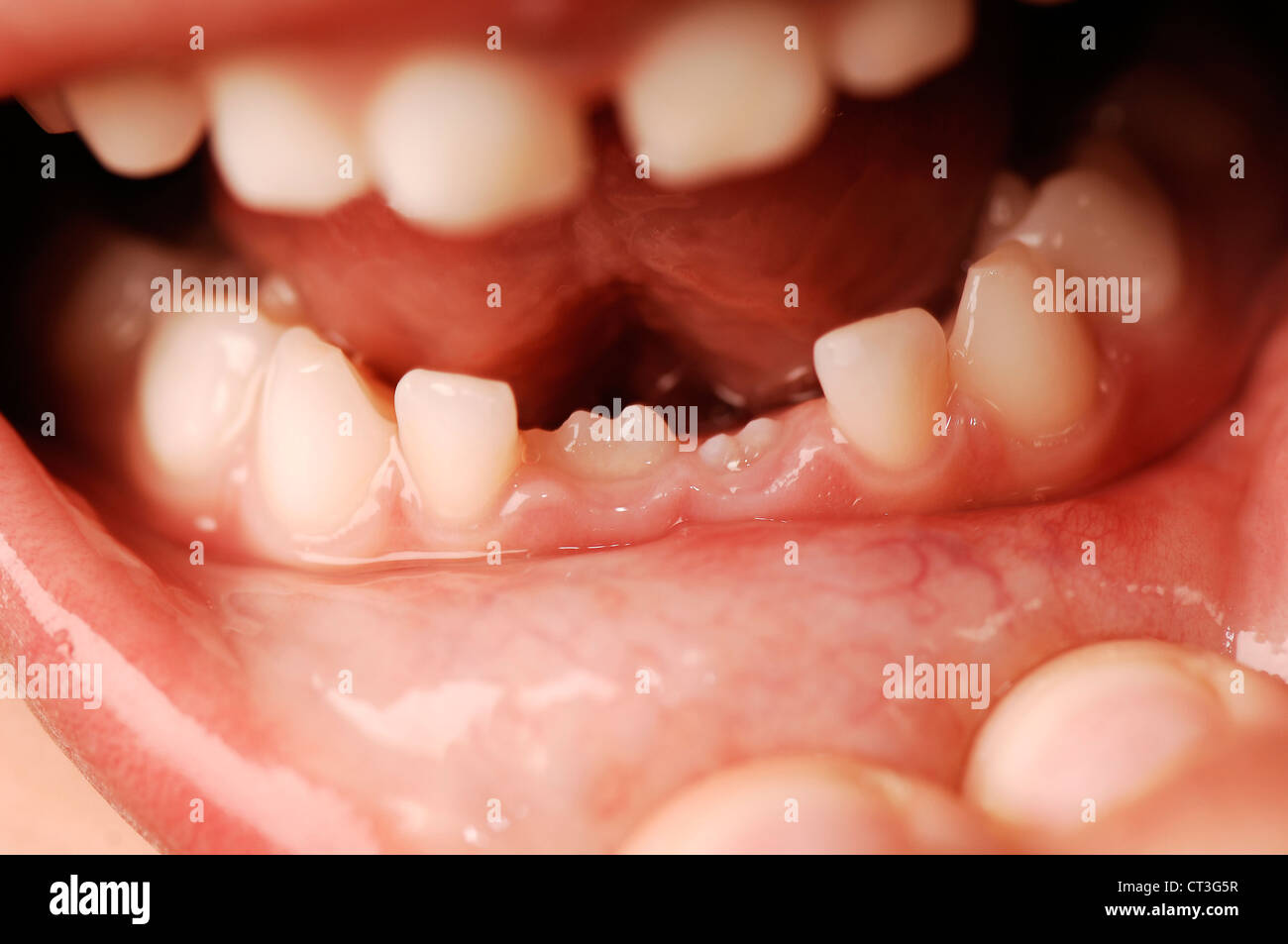 grounded milk molars grounded milk molars