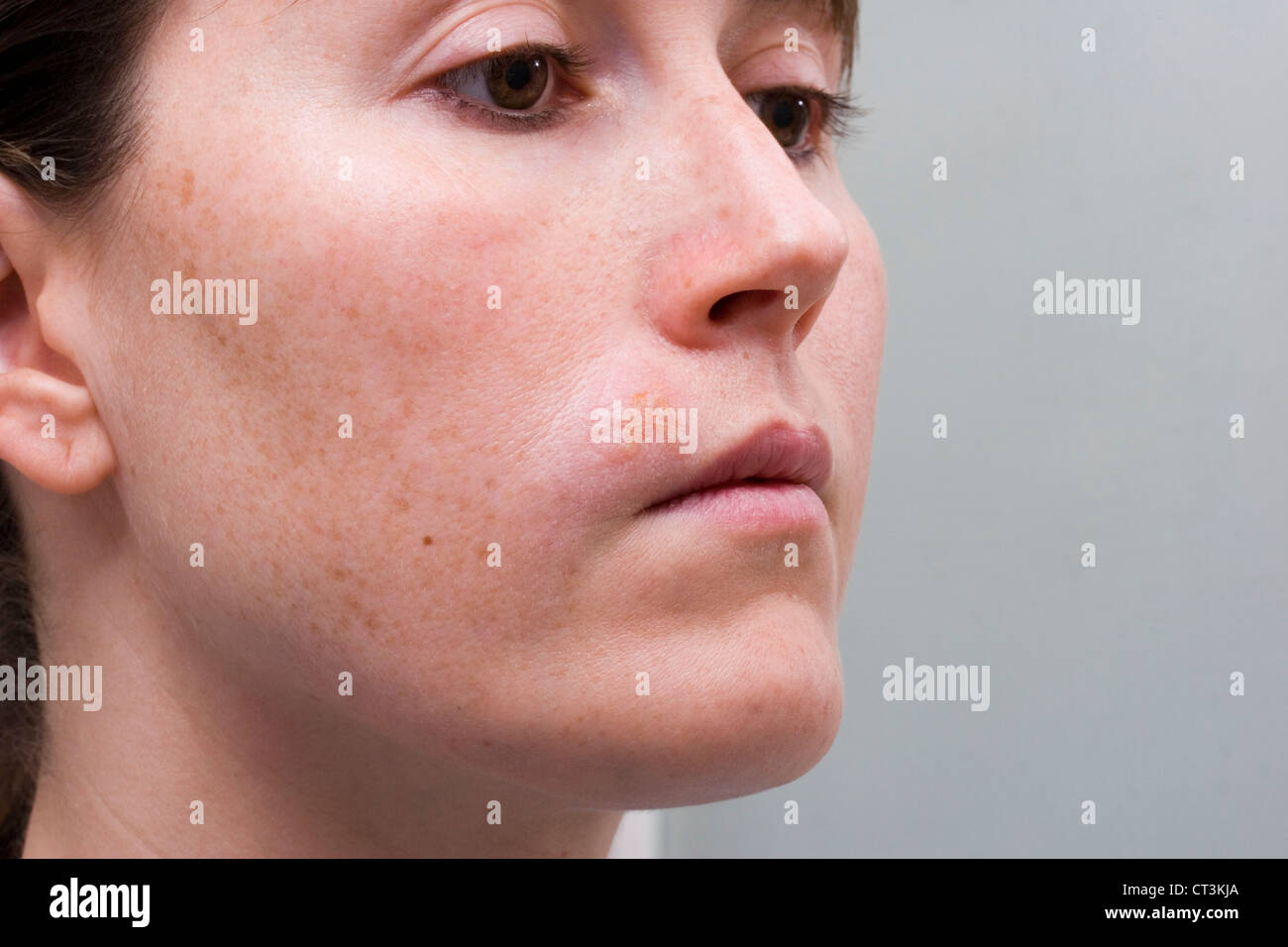 Herpes labial interior hires stock photography and images Alamy