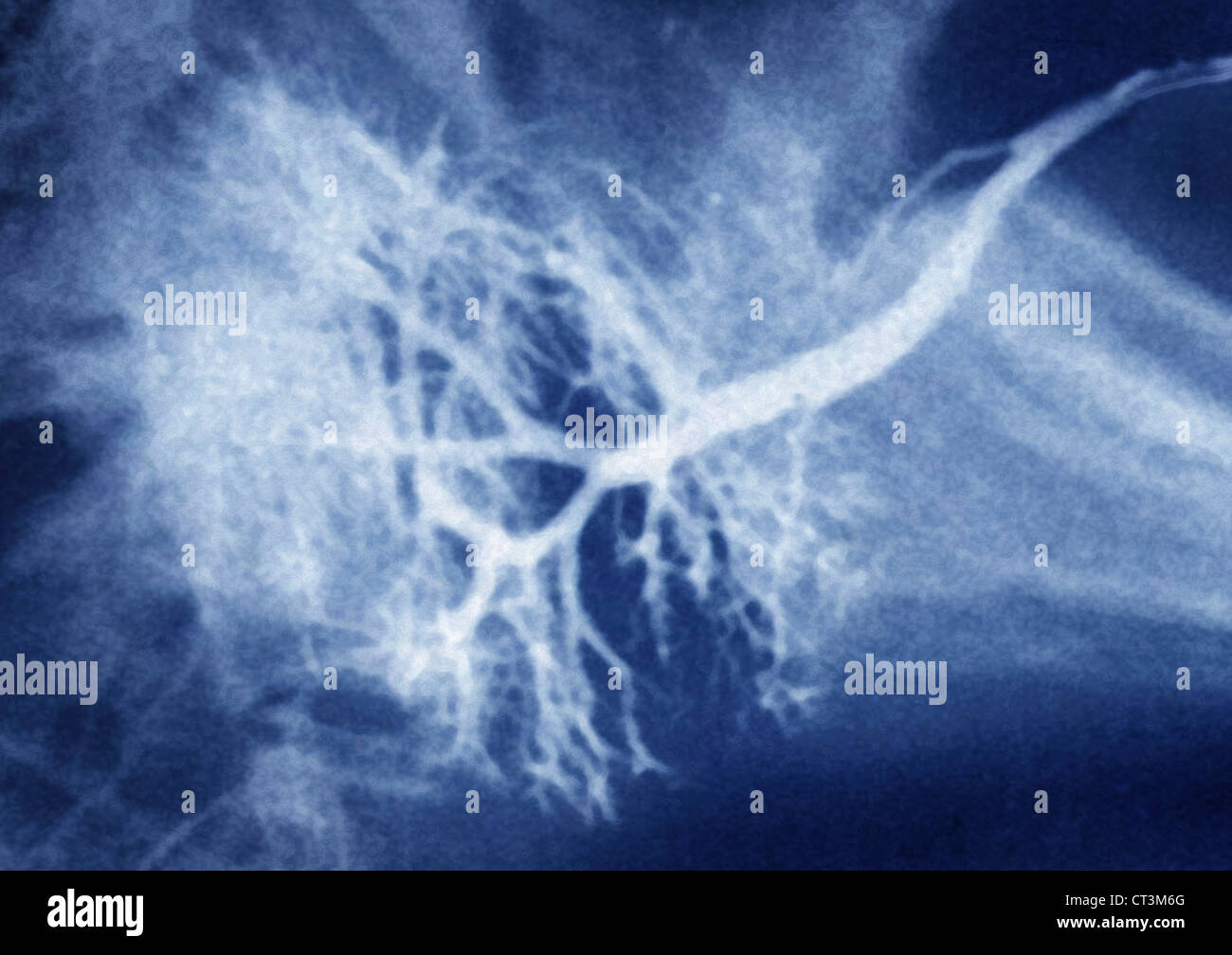 SALIVARY GLAND, XRAY Stock Photo Alamy