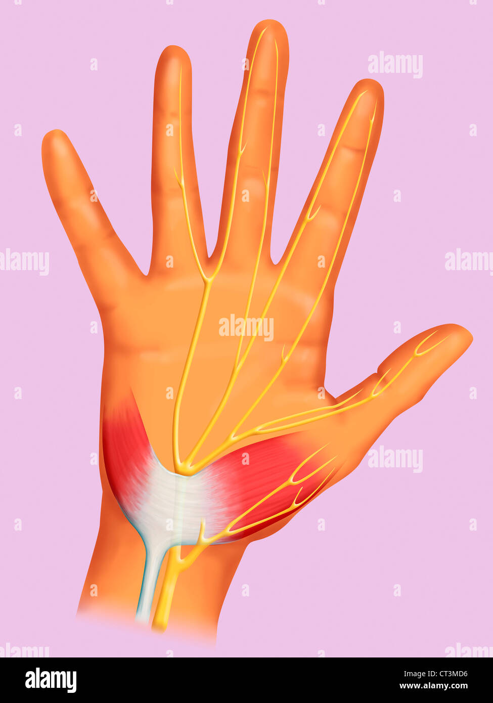 CARPAL TUNNEL, DRAWING Stock Photo