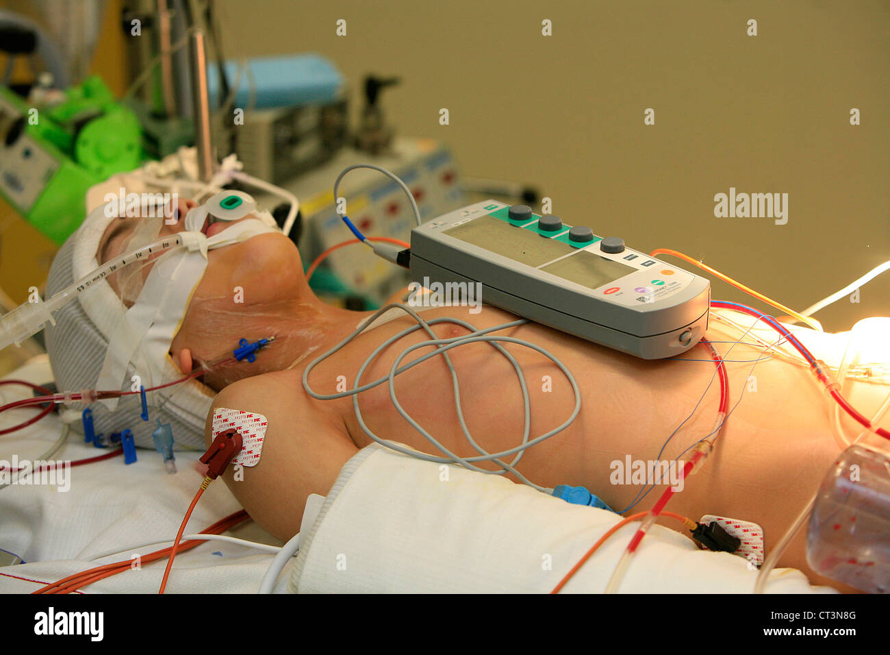 MONITORING A PACEMAKER Stock Photo Alamy