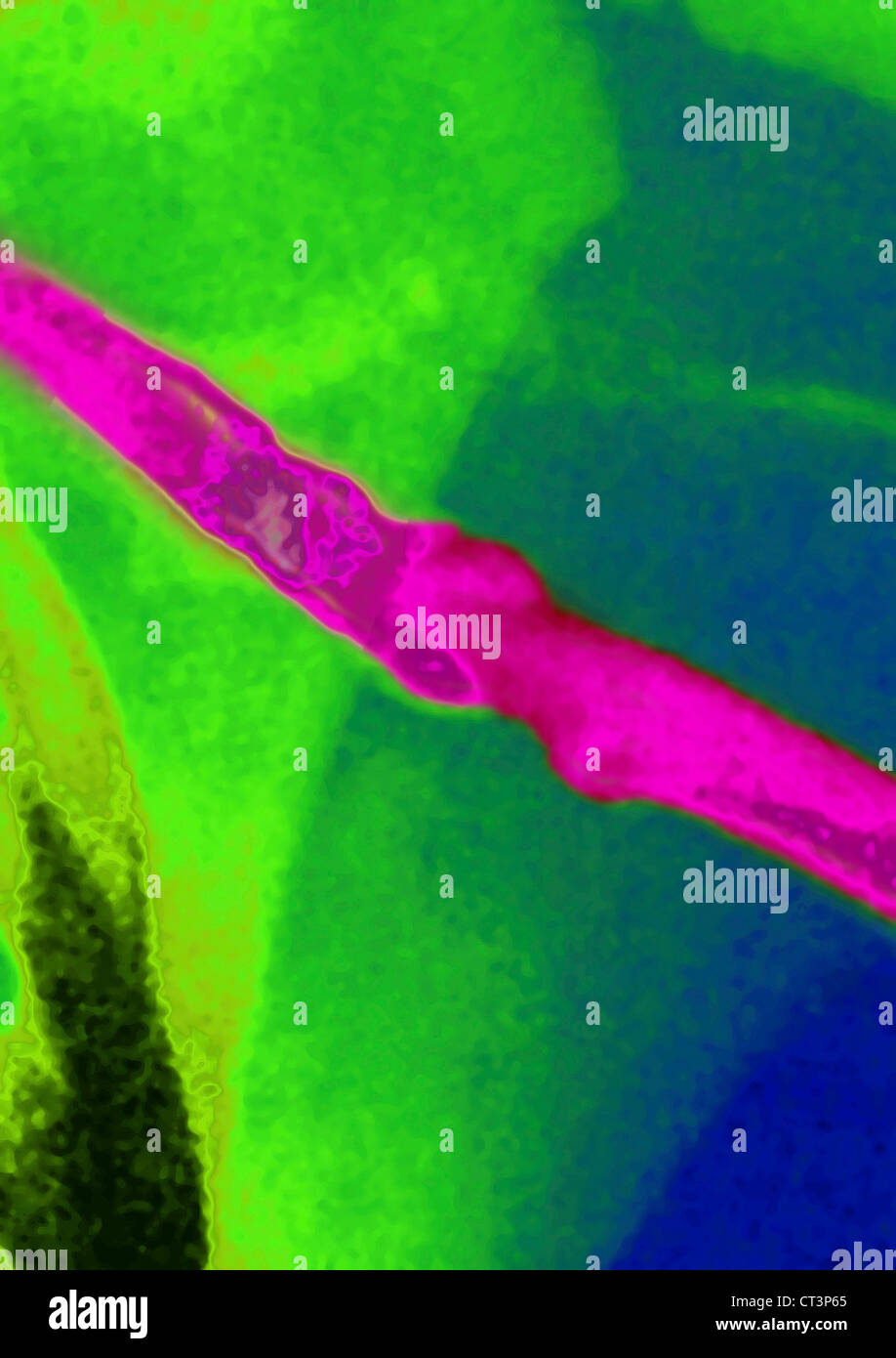 Venous Blood Vessels High Resolution Stock Photography and Images - Alamy