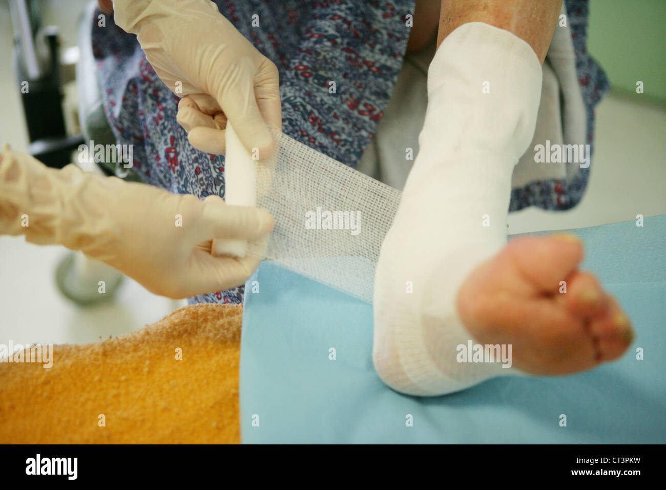 Bedsores Stock Photos & Bedsores Stock Images Alamy